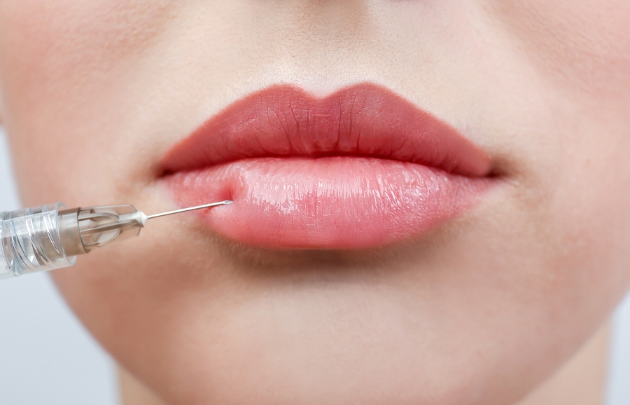 Lip Fillers Chelsea & Bournemouth EdenMed Clinic Aesthetics