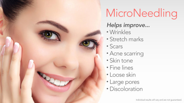 microneedle, microneedling, mesotherapy, PRP, platelet rich plasma, acne, scar, rosacea, inflammation, skin, treatment, clinic, benefits, smoothness, plumping,