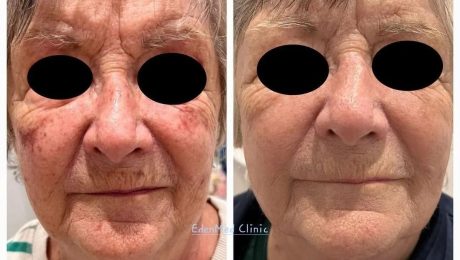 skin laser clinic