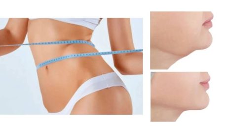 endolift, last, duration, skin laser, poole, bournemouth, london, chelsea, edenmed clinic, laser clinic, non surgical, facelift