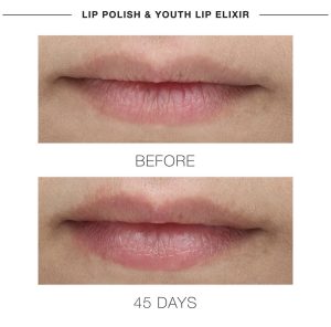 is clinical youth lip elixir
