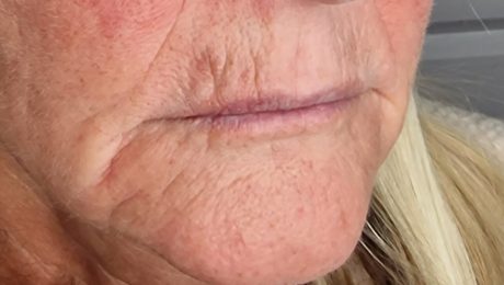 older, mature lips, anaotomy, changes
